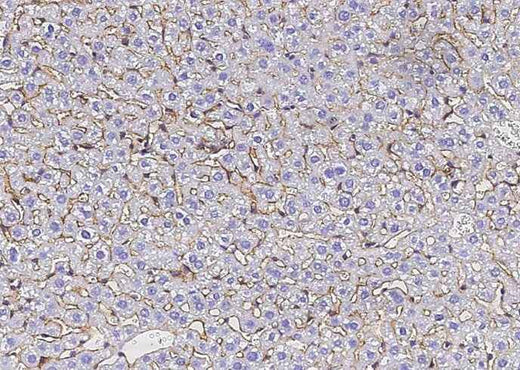 Anti-Mouse SerpinF2 Antibody [B415] - ABMIUM