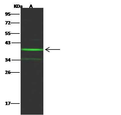 Anti-Human NT5C3A Antibody [B370] - ABMIUM