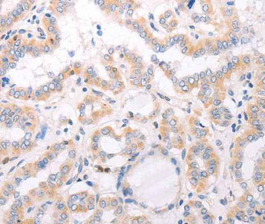 Anti-Human/Mouse CIDEB Antibody - ABMIUM