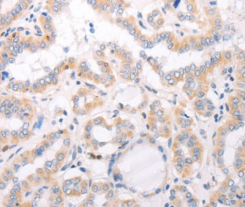 Anti-Human/Mouse CIDEB Antibody - ABMIUM