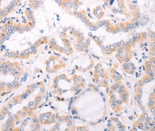 Anti-Human/Mouse CIDEB Antibody - ABMIUM