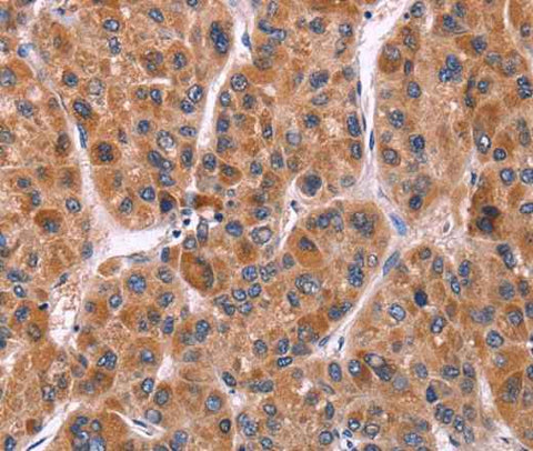 Anti-Human/Mouse/Rat Ephrin A5 Antibody