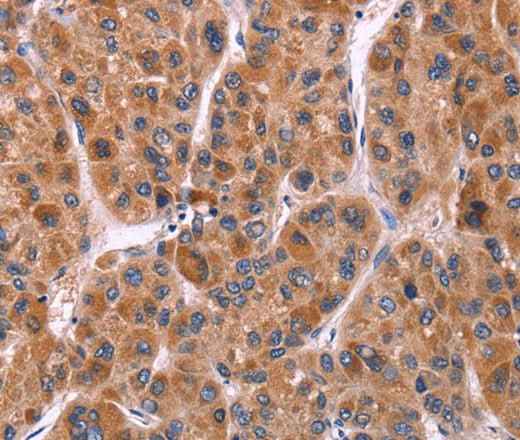 Anti-Human/Mouse/Rat Ephrin A5 Antibody