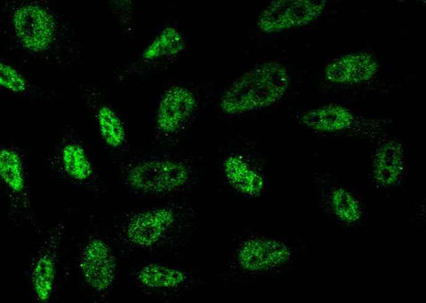 Anti-Human TBXT Antibody [A1012] - ABMIUM