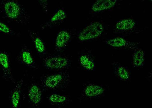 Anti-Human TBXT Antibody [A1012] - ABMIUM