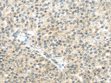 Anti-Human/Mouse TTBK2 Antibody - ABMIUM