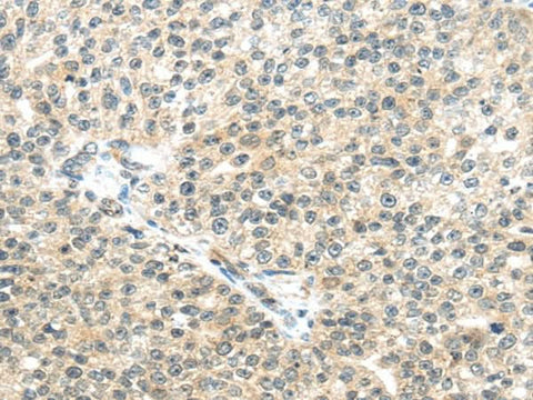 Anti-Human/Mouse TTBK2 Antibody - ABMIUM