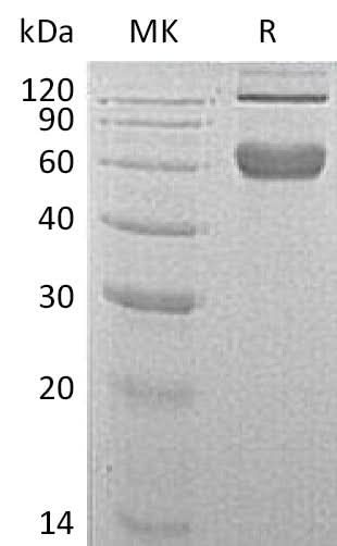 Recombinant Mouse 4-1BB/TNFRSF9 Protein (aa 24-187, Fc Tag) - ABMIUM