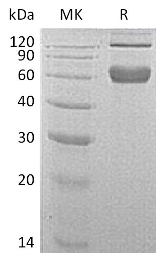 Recombinant Mouse 4-1BB/TNFRSF9 Protein (aa 24-187, Fc Tag) - ABMIUM