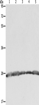 Anti-Human/Mouse/Rat PRDX3 Antibody - ABMIUM