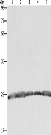 Anti-Human/Mouse/Rat PRDX3 Antibody - ABMIUM