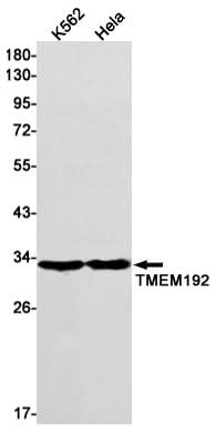 Western blot detection of TMEM192 in K562,Hela cell lysates using TMEM192 Rabbit mAb(1:1000 diluted).Predicted band size:31kDa.Observed band size:31kDa.