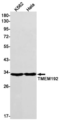 Western blot detection of TMEM192 in K562,Hela cell lysates using TMEM192 Rabbit mAb(1:1000 diluted).Predicted band size:31kDa.Observed band size:31kDa.