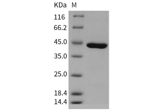Recombinant Human Carboxypeptidase A1/CPA1 Protein (His Tag) - ABMIUM