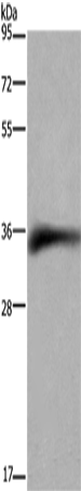 Anti-Human CD32 Antibody - ABMIUM