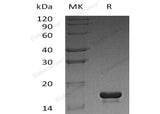 Recombinant Human Cystatin C/CST3 Protein (E.coli, His Tag) - ABMIUM