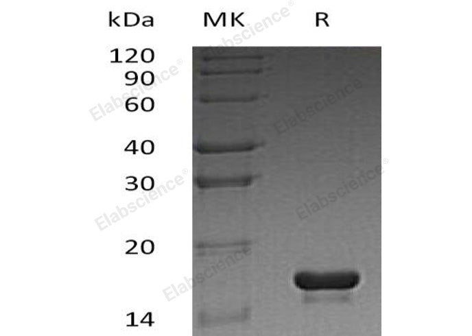 Recombinant Human Cystatin C/CST3 Protein (E.coli, His Tag) - ABMIUM