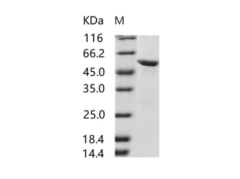 Recombinant HIV-2 gp36 Protein (subtype CRF01_AB, strain 07JP_NMC716_clone_01) (His & MBP Tag) - ABMIUM