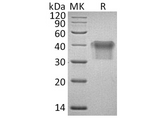Recombinant Human IL2Ra/CD25 Protein (His Tag) - ABMIUM
