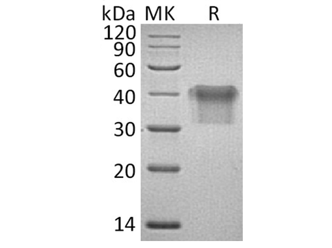 Recombinant Human IL2Ra/CD25 Protein (His Tag) - ABMIUM