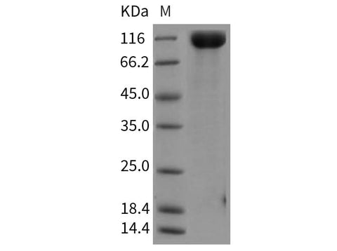 Recombinant Rat VEGFR1/FLT-1 Protein (His Tag) - ABMIUM