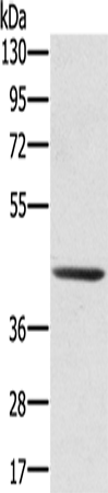 Anti-Human/Mouse/Rat SCPEP1 Antibody - ABMIUM