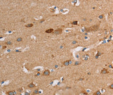 Anti-Human/Mouse TLR8 Antibody - ABMIUM