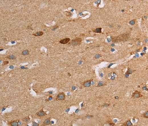 Anti-Human/Mouse TLR8 Antibody
