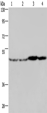 Anti-Human/Mouse/Rat FH Antibody - ABMIUM