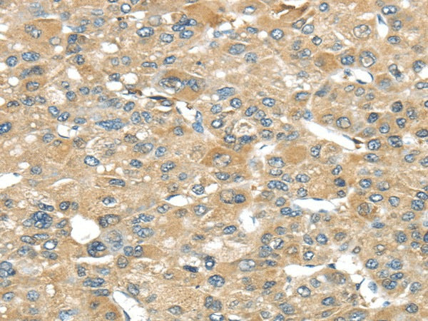 Anti-Human/Mouse/Rat SRP54 Antibody - ABMIUM
