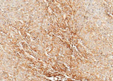 Anti-Human CLEC3B Antibody [A1172] - ABMIUM