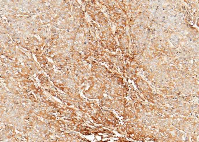 Anti-Human CLEC3B Antibody [A1172] - ABMIUM