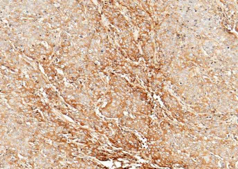 Anti-Human CLEC3B Antibody [A1172] - ABMIUM