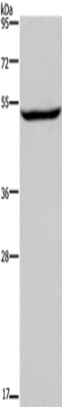 Anti-Human/Mouse/Rat IMPDH1 Antibody - ABMIUM