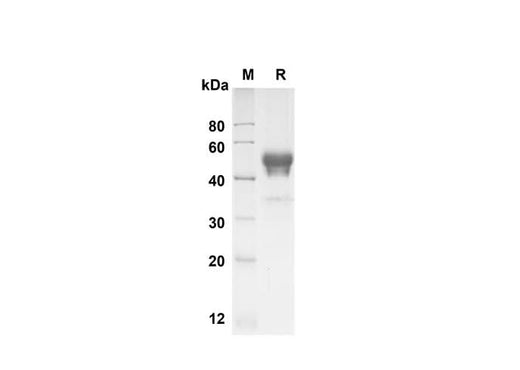 SDS-PAGE analysis of Human ALK-1 proteins , 2 μg/lane of Recombinant Human ALK-1 proteins was resolved with SDS-PAGE under reducing conditions , showing bands at 50 kDa.