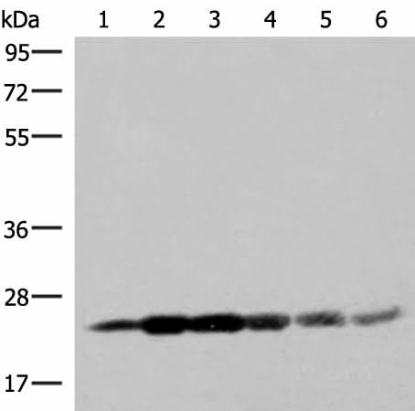 Western blot analysis of 293T cell lysates using GSTK1 Polyclonal Antibody at dilution of 1:250
