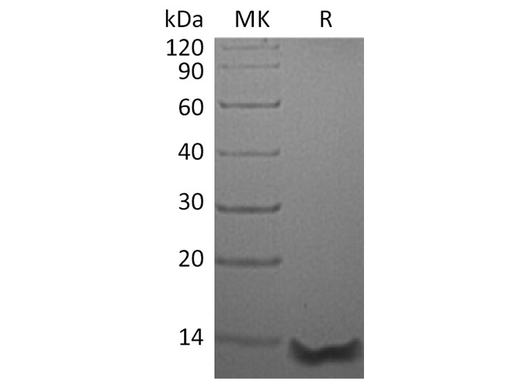 Recombinant Human Eotaxin-3/CCL26 Protein (aa 27-94) - ABMIUM