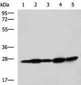 Western blot analysis of Mouse liver tissue Mouse brain tissue Rat brain tissue Rat liver tissue and Human fetal liver tissue lysates using QDPR Polyclonal Antibody at dilution of 1:800
