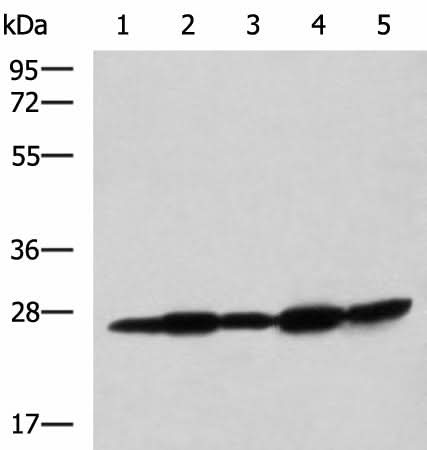 Western blot analysis of Mouse liver tissue Mouse brain tissue Rat brain tissue Rat liver tissue and Human fetal liver tissue lysates using QDPR Polyclonal Antibody at dilution of 1:800