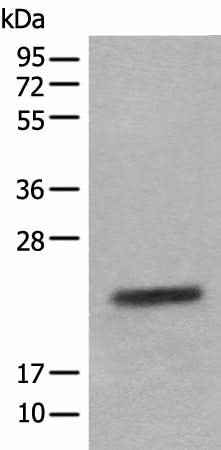 Anti-Human/Mouse/Rat CRYGS Antibody
