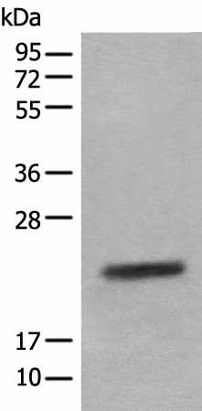 Western blot analysis of Mouse eye tissue lysate using CRYGS Polyclonal Antibody at dilution of 1:800