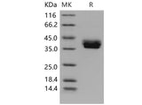 Recombinant Mouse CADM3 Protein (His Tag) - ABMIUM