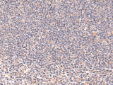 Immunohistochemistry of paraffin-embedded Human tonsil tissue using MANSC1 Polyclonal Antibody at dilution of 1:105(×200)