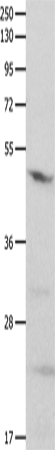 Anti-Human/Mouse/Rat GNAS Antibody - ABMIUM