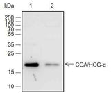 Anti-Human/Rat/Mouse CGA/hCG alpha Antibody [A684]