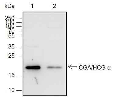 Anti-Human/Rat/Mouse CGA/hCG alpha Antibody [A684] - ABMIUM