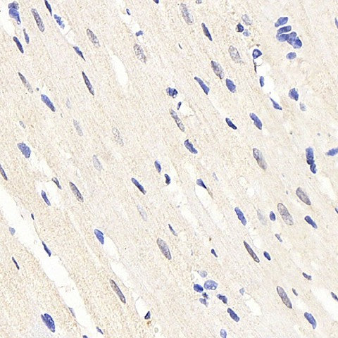 Immunohistochemistry analysis of paraffin-embedded rat heart using HES2 Polyclonal Antibody at dilution of 1:200.