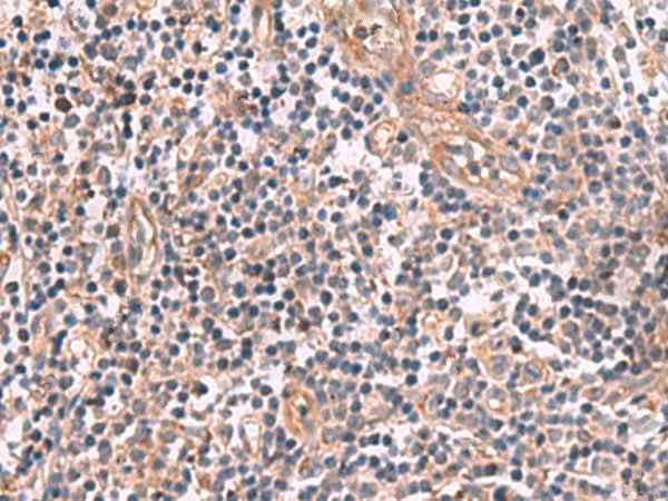 Anti-Human/Mouse/Rat MGP Antibody