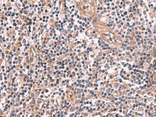 Anti-Human/Mouse/Rat MGP Antibody