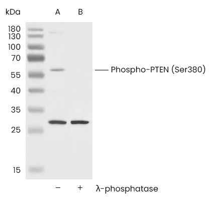 Anti-Human PTEN Antibody [A1261] - ABMIUM